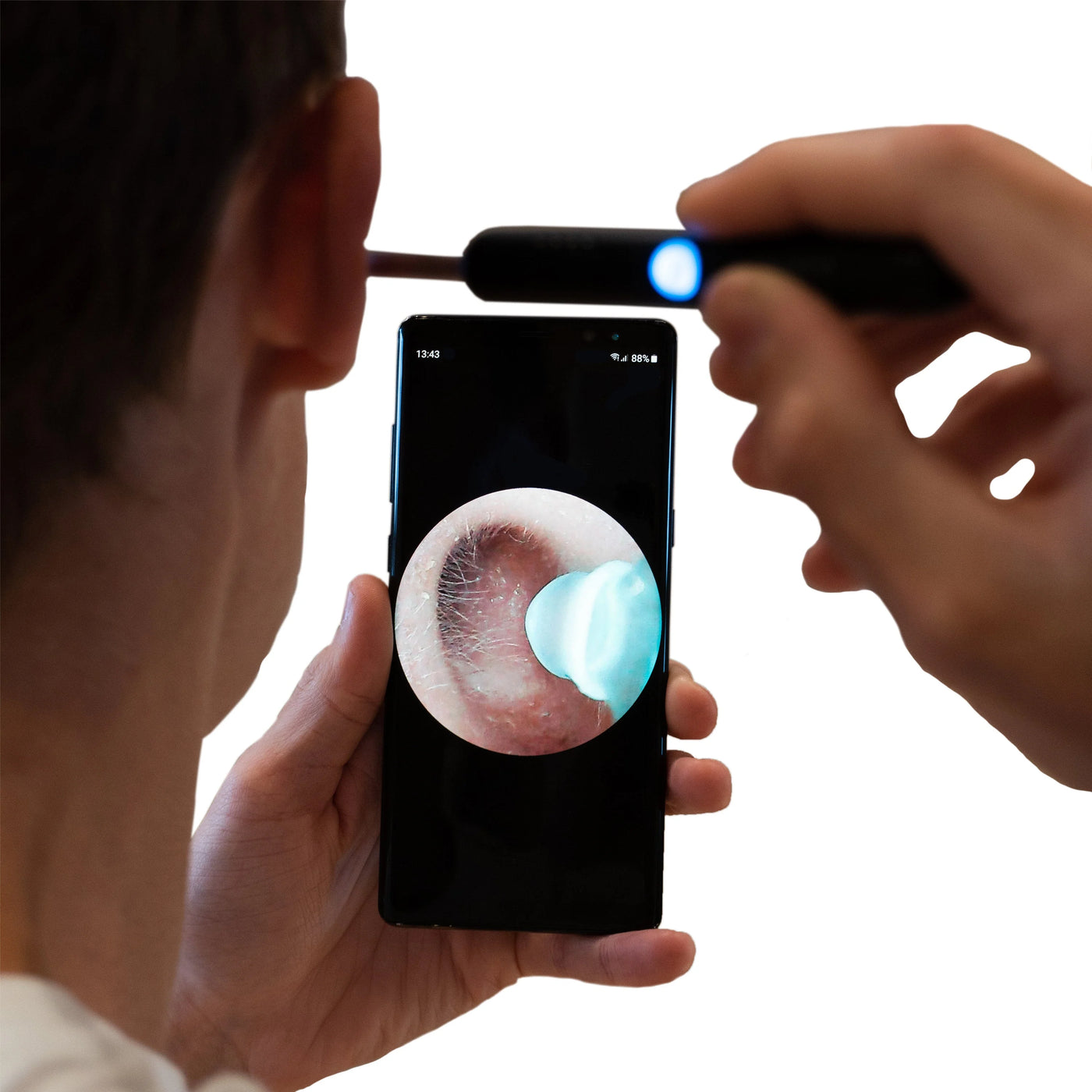 PureScope™ Smart Ear Cleaner