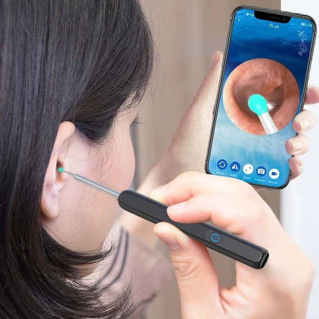 PureScope™ Smart Ear Cleaner